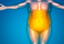 El tamaño del abdomen importa: un estudio advierte que la adiposidad central aumenta el riesgo de infarto y ACV